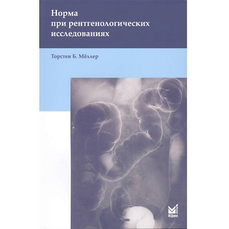 Фото Норма при рентгенологических исследованиях . Мёллер Т.Б.