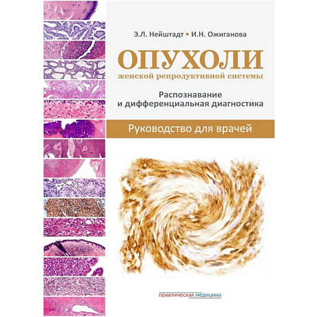Фото Опухоли женской репродуктивной системы. Распознавание и дифференциальная диагностика. Руководство для врачей