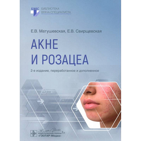 Фото Акне и розацеа