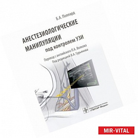 Анестезиологические манипуляции под контролем УЗИ