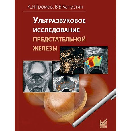 Фото Ультразвуковое исследование предстательной железы