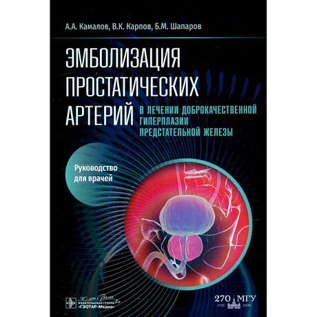 Фото Эмболизация простатических артерий в лечении доброкачественной гиперплазии предстательной железы: руководство для врачей