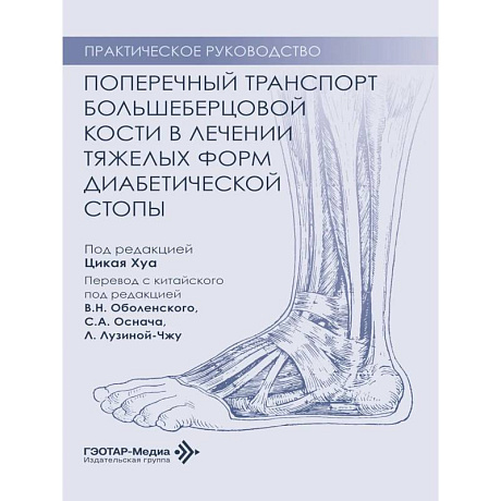 Фото Поперечный транспорт большеберцовой кости в лечении тяжелых форм диабетической стопы. Практическое руководство