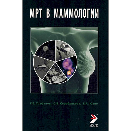 Фото МРТ в маммологии: руководство для врачей