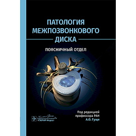 Патология межпозвонкового диска. Поясничный отдел