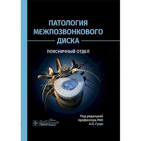 Фото Патология межпозвонкового диска. Поясничный отдел