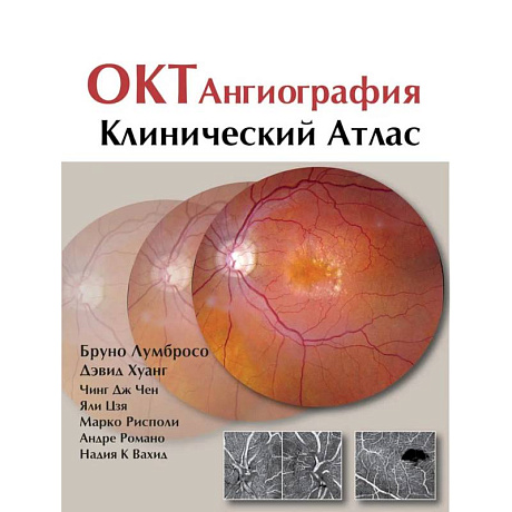 Фото ОКТ-ангиография. Клинический атлас