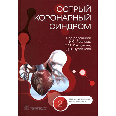 Фото Острый коронарный синдром