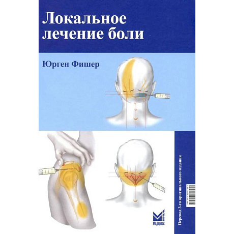 Фото Локальное лечение боли