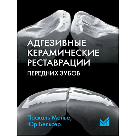 Адгезивные керамические реставрации передних зубов