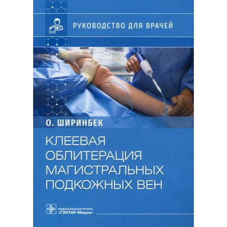 Фото Клеевая облитерация магистральных подкожных вен