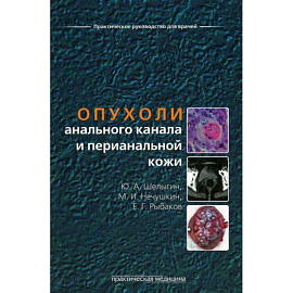 Опухоли анального канала и перианальной кожи