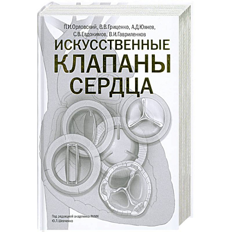 Фото Искусственные клапаны сердца