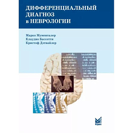 Дифференциальный диагноз в неврологии. Руководство по оценке, классификации и дифференциональной диагностике неврологических симптомов