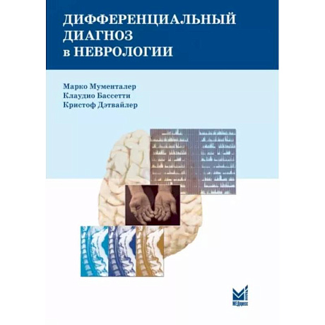 Фото Дифференциальный диагноз в неврологии. Руководство по оценке, классификации и дифференциональной диагностике неврологических симптомов