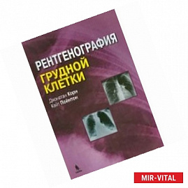 Рентгенография грудной клетки
