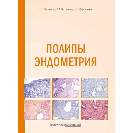 Фото Полипы эндометрия: Учебное пособие