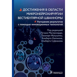 Достижения в области микронейрохирургии вестибулярной шванномы