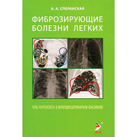 Фиброзирующие болезни легких. Роль рентгенолога в мультидисциплинарном консилиуме