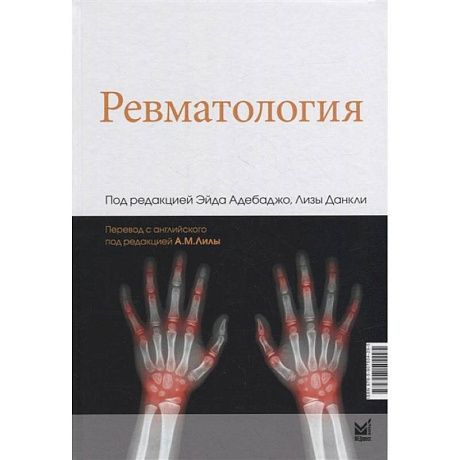 Фото Ревматология. Под ред. Адебаджо Э.