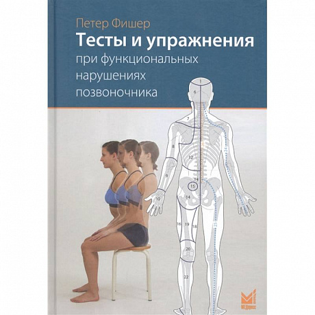 Фото Тесты и упражнения при функциональных нарушениях позвоночника