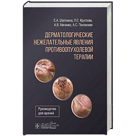 Фото Дерматологические явления противоопухолевой терапии