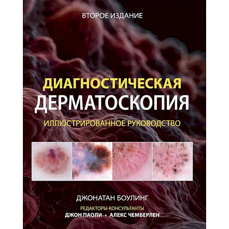 Фото Диагностическая дерматоскопия: иллюстрированное руководство
