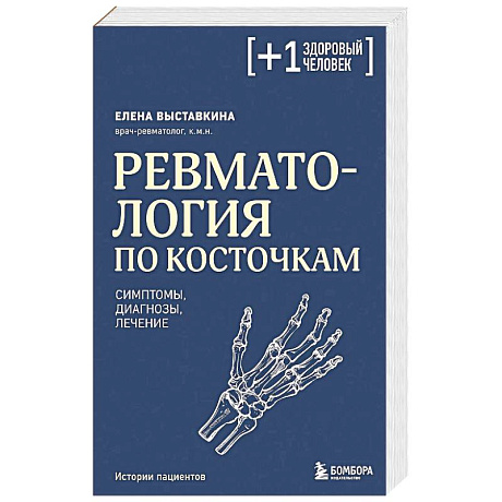 Фото Ревматология по косточкам. Симптомы, диагнозы, лечение