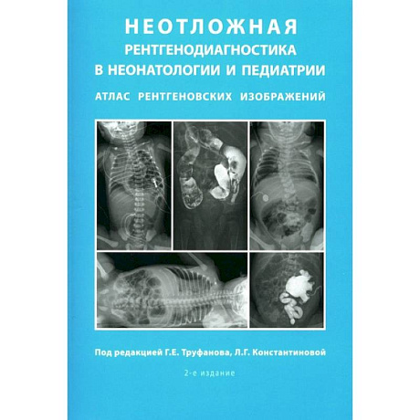 Фото Неотложная рентгенодиагностика в неонатологии и педиатрии. Атлас рентгеновских изображений. Учебное пособие