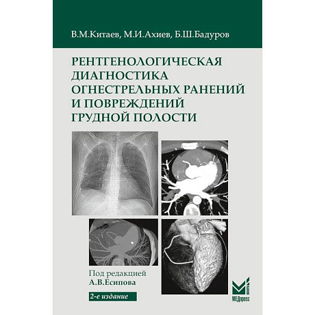 Фото Рентгенологическая диагностика огнестрельных ранений и повреждений грудной полости