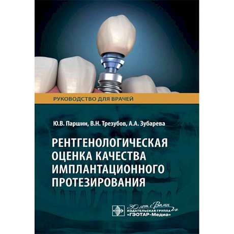 Фото Рентгенологическая оценка качества имплантационного протезирования