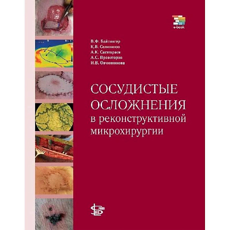 Фото Сосудистые осложнения в реконструктивной микрохирургии