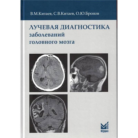 Фото Лучевая диагностика заболеваний головного мозга