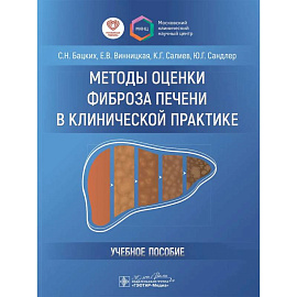 Методы оценки фиброза печени в клинической практике
