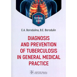 Diagnosis and prevention of tuberculosis in general medical practice: tutorial guide = Диагностика и профилактика туберкулеза в общей врачебной практи