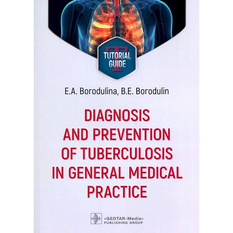 Фото Diagnosis and prevention of tuberculosis in general medical practice: tutorial guide = Диагностика и профилактика туберкулеза в общей врачебной практи