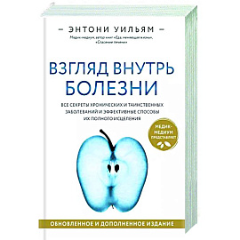 Взгляд внутрь болезни. Все секреты хронических и таинственных заболеваний