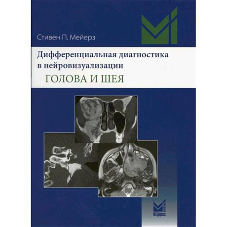 Фото Дифференциальная диагностика в нейровизуализации. Голова и шея