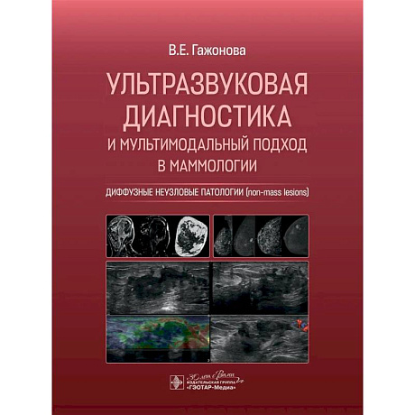 Фото Ультразвуковая диагностика и мультимодальный подход в маммологии. Диффузные неузловые патологии