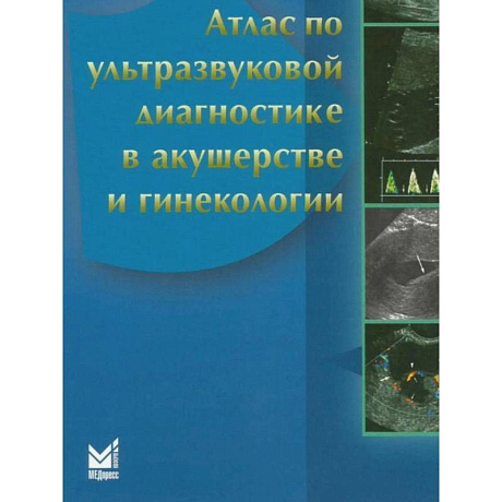 Фото Атлас по ультразвуковой диагностике в акушерстве и гинекологии