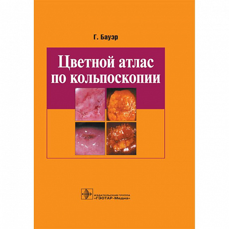 Фото Цветной атлас по кольпоскопии