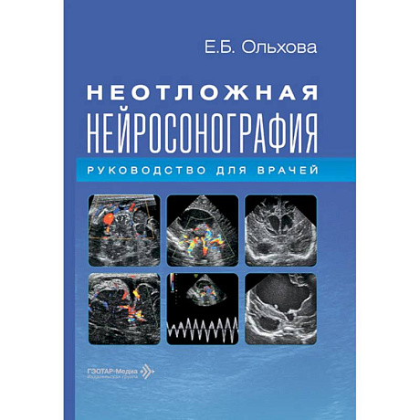 Фото Неотложная нейросонография: руководство для врачей