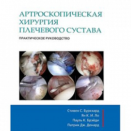 Артроскопическая хирургия плечевого сустава. Практическое руководство