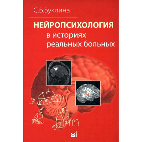 Фото Нейропсихология в историях реальных больных