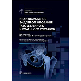 Индивидуальное эндопротезирование тазобедренного и коленного суставов