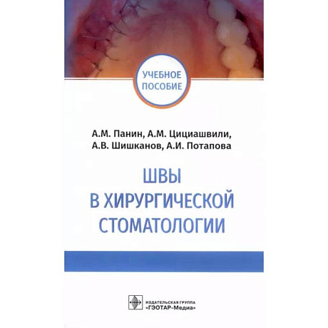 Фото Швы в хирургической стоматологии
