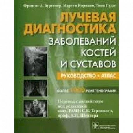 Фото Лучевая диагностика заболеваний костей и суставов