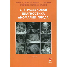 Ультразвуковая диагностика аномалий плода: Руководство для врачей