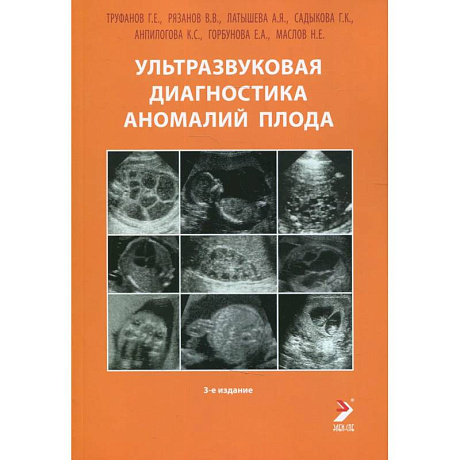 Фото Ультразвуковая диагностика аномалий плода: Руководство для врачей