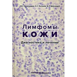 Лимфомы кожи. Диагностика и лечение